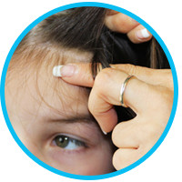 head-lice-treatment