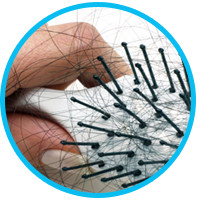does-stress-really-cause-hair-loss